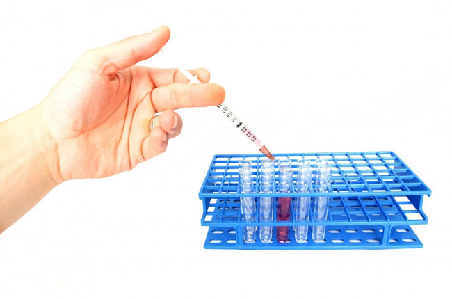 What Small Businesses Need to Know about Employee Drug Testing